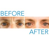 /album/fotogaleria/before-after-jpg/